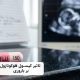 آیا فلوکونازول برای بارداری ضرر دارد؟