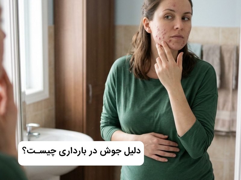 چرا در بارداری جوش میزنیم؟ چرا در بارداری جوش میزنیم؟